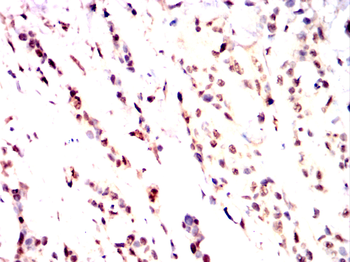 CBFA2T3 Antibody