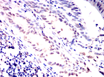 CBFA2T3 Antibody