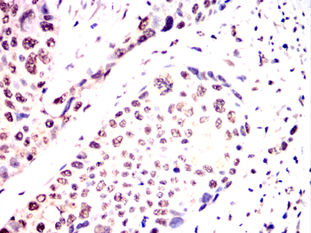 CBFA2T3 Antibody