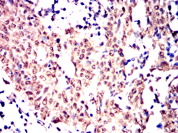 CBFA2T3 Antibody