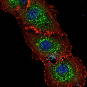 RAB21 Antibody