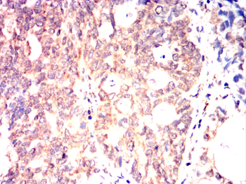 RAB21 Antibody