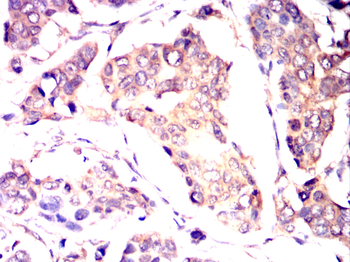 RAB21 Antibody