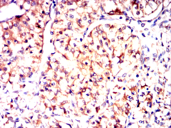 RAB21 Antibody