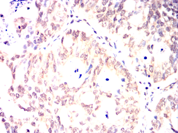 SUMO2 Antibody