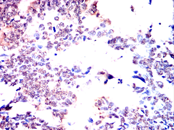 SUMO2 Antibody