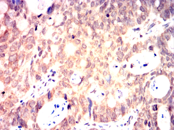 ITK Antibody