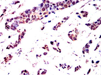 ITK Antibody