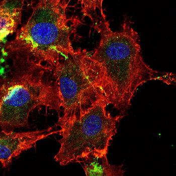 PSMB8 Antibody