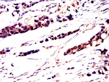 PSMB8 Antibody