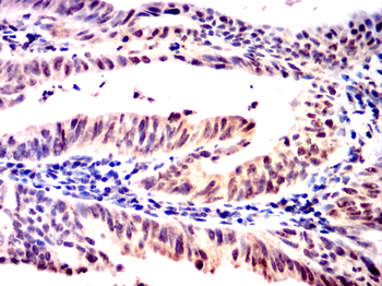 PSMB8 Antibody