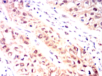 PSMB8 Antibody