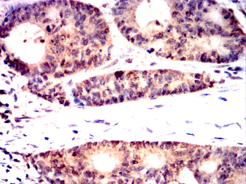 PSMB8 Antibody