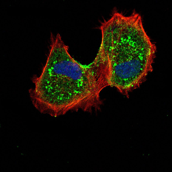 G6PD Antibody