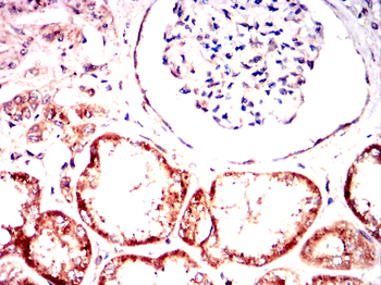G6PD Antibody