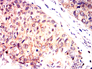 G6PD Antibody