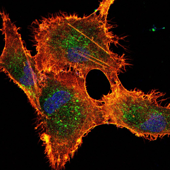 PPP1CA Antibody