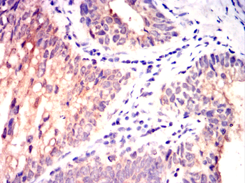 PPP1CA Antibody