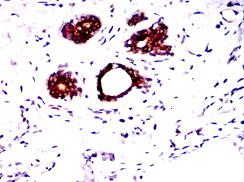 PPP1CA Antibody