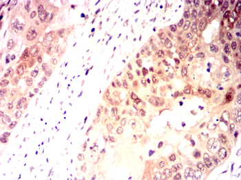 PPP1CA Antibody