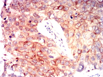 PPP1CA Antibody
