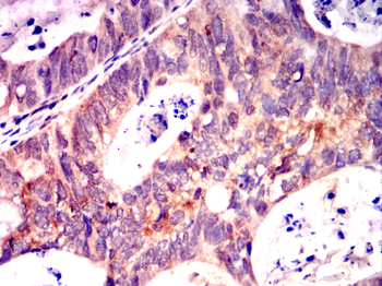 PTPA Antibody