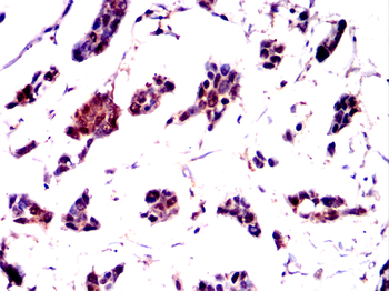 PTPA Antibody