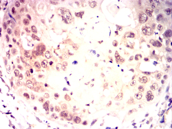 PTPA Antibody