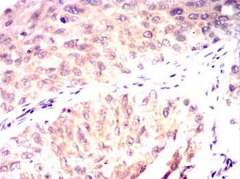 PTPA Antibody