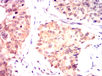 RAB20 Antibody
