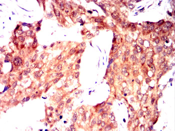 GSTM1 Antibody