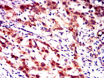 GSTM1 Antibody