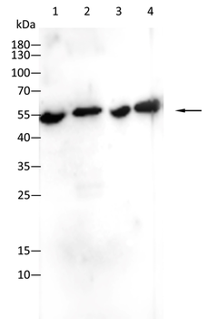 GSTM1 Antibody