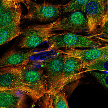 BPIFB1 Antibody