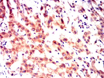 DLK1 Antibody