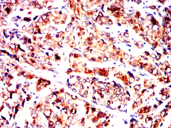 DLK1 Antibody
