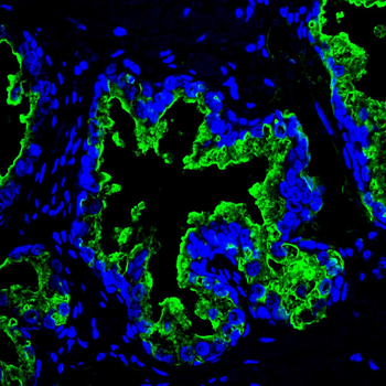 DLK1 Antibody
