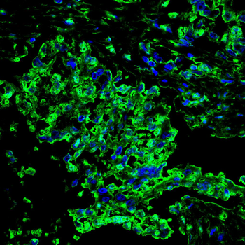 BMI1 Antibody