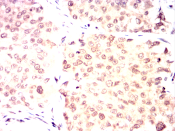 BMI1 Antibody