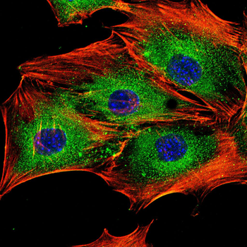 TNNI2 Antibody