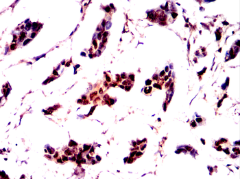 TNNI2 Antibody