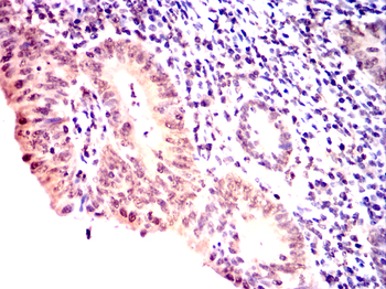 TNNI2 Antibody