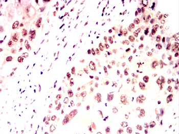 TNNI2 Antibody
