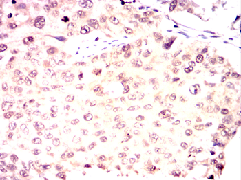 TNNI2 Antibody