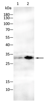 TNNI2 Antibody