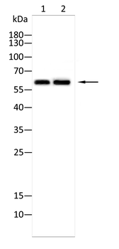 NEFL Antibody