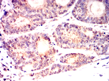 PKN2 Antibody