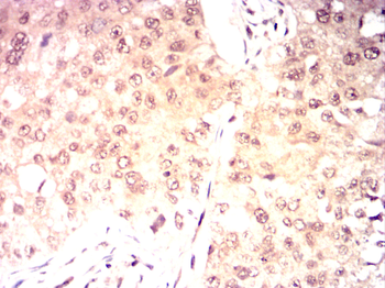 RPA1 Antibody