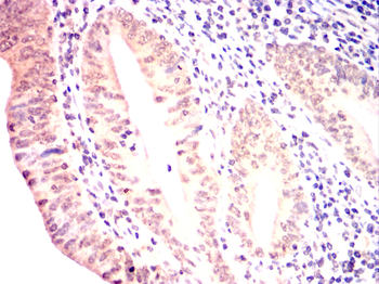 RPA1 Antibody