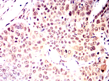 MAPK8 Antibody